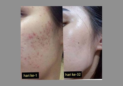 F S N Natural Beauty