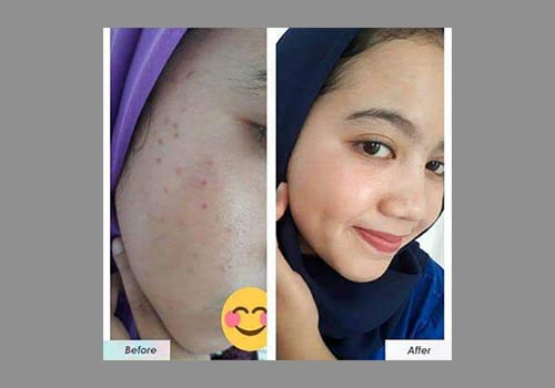 F S N Natural Beauty